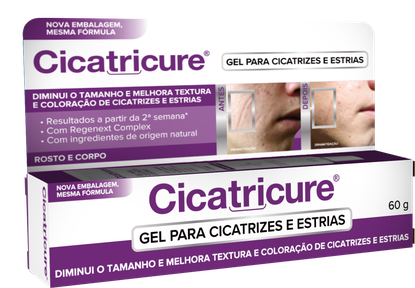 Cicatricure® Gel Cicatrizes e Estrias